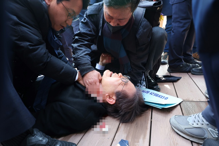 South Korean opposition party leader Lee Jae-myung is attended to after being stabbed in Busan on Tuesday